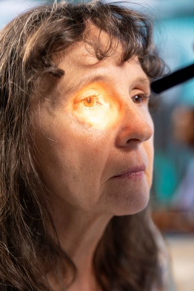 Tratamiento para cataratas en Tijuana