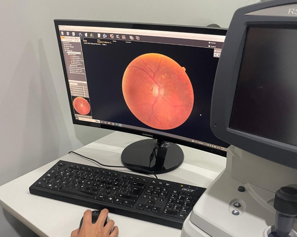 oftalmólogo explicando resultados de la vista en monitor en tijuana