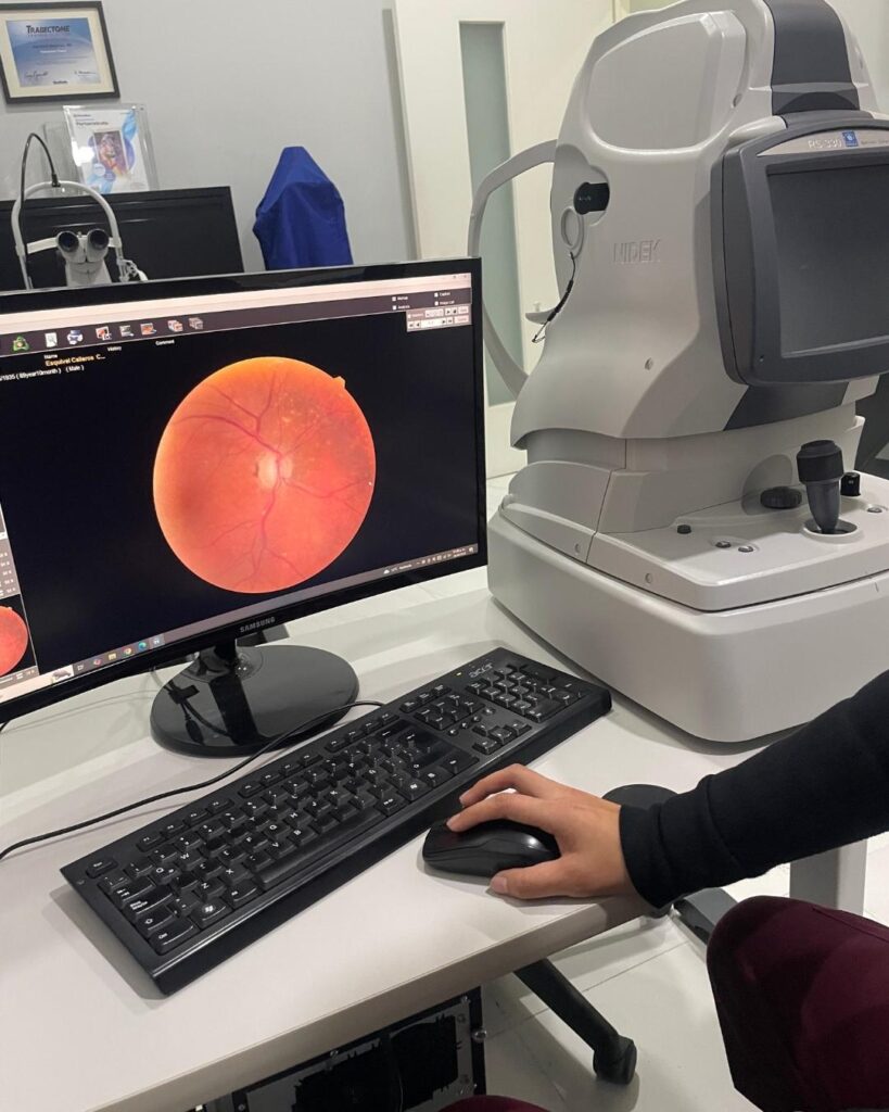 mostrando imágenes del ojo en monitor de computadora